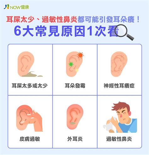 耳朵癢時間|耳癢：症狀、病因及如何治療